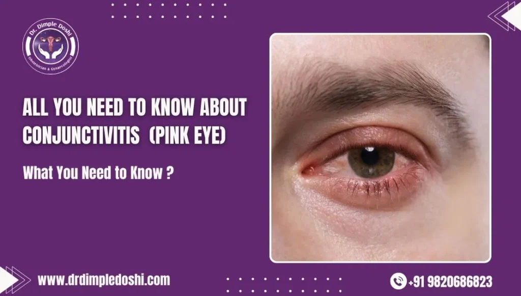 All You Need to Know About Conjunctivitis (Pink Eye)