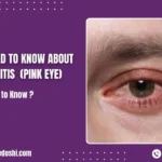 All You Need to Know About Conjunctivitis (Pink Eye)