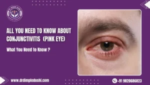 All You Need to Know About Conjunctivitis (Pink Eye)