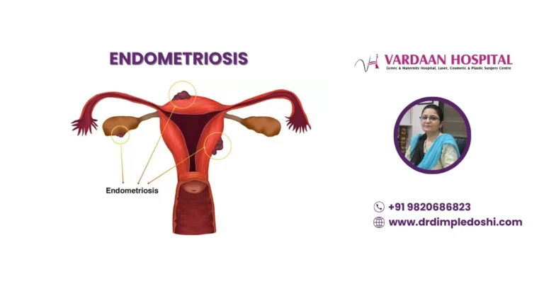 Endometriosis Treatment