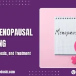 Postmenopausal Bleeding Causes, Diagnosis, and Treatment