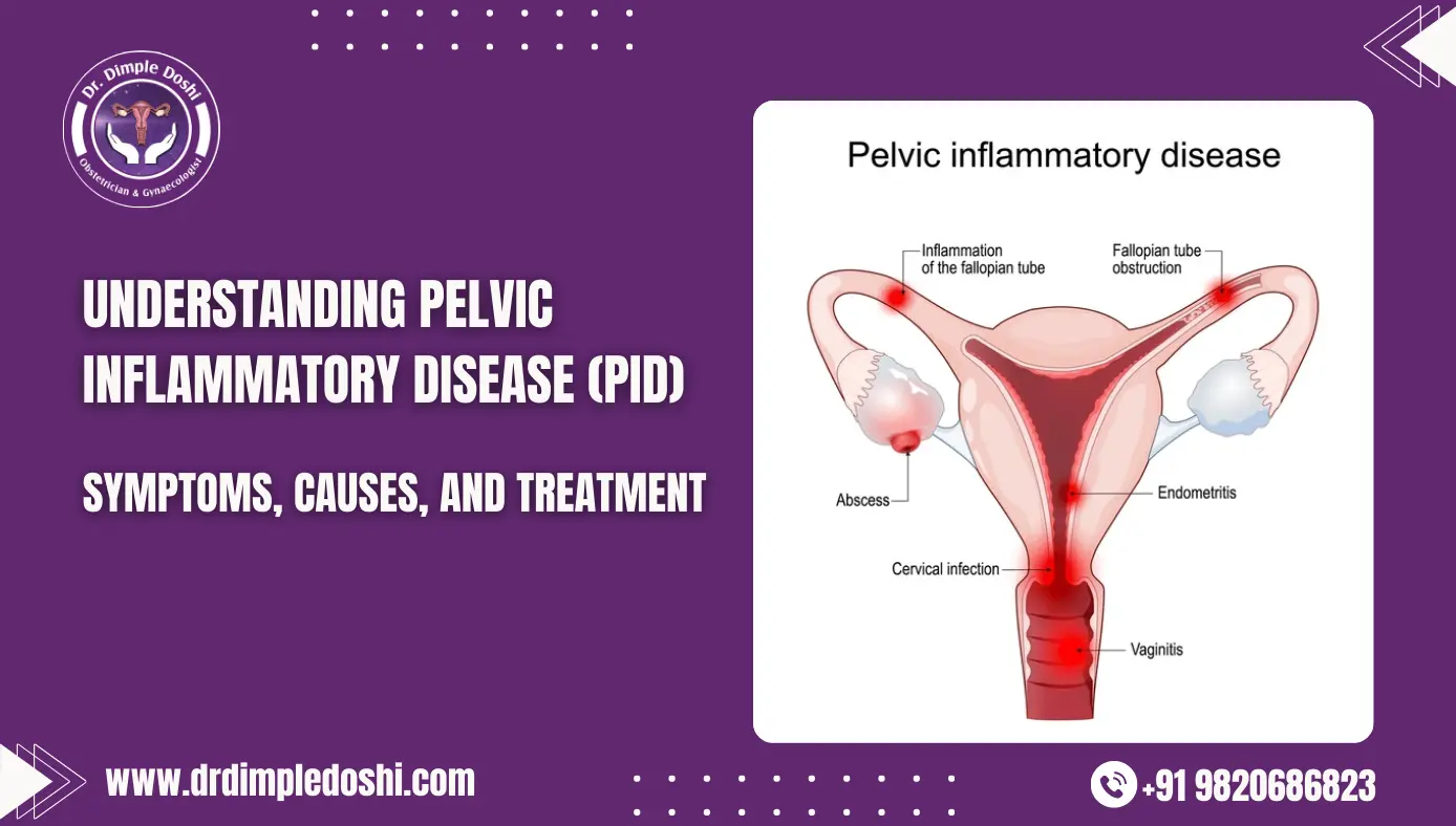 UNDERSTANDING PELVIC INFLAMMATORY DISEASE (PID)