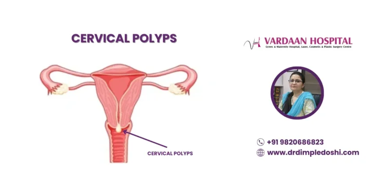 cervical polyps